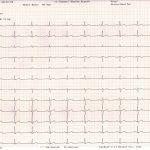گالری دستگاه «نوار قلب ۱۲ کاناله» ایمهوتپ